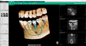 digital xrays on computer screen